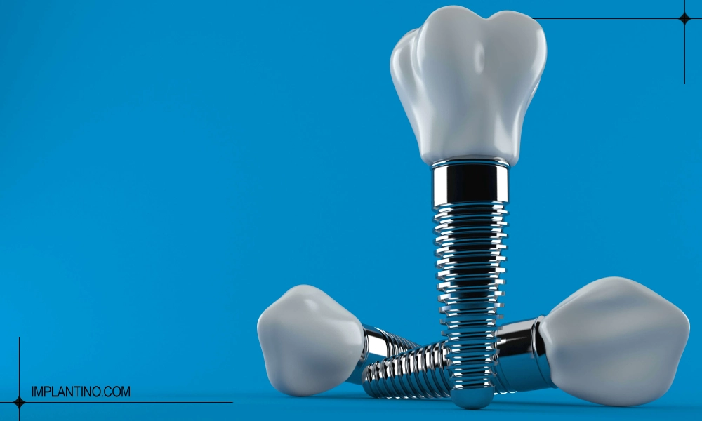 عکس سه عدد ایمپلنت دندان | ایمپلنت برای بیماران قلبی