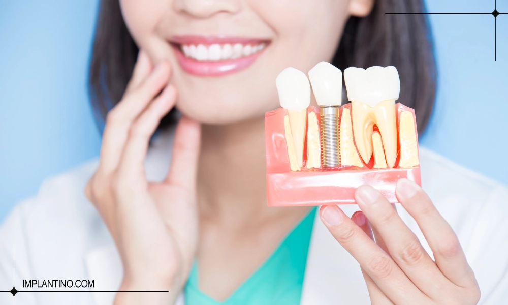 پزشک خانم در حال نشان دادن ماکت ایمپلنت دندان | ایمپلنت برای بیماران قلبی