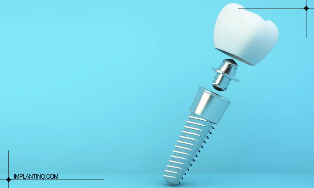 ایمپلنت CIS کره ای | بررسی کامل ویژگی ها و مزایای CIS 2 ایمپلنت CIS کره ای