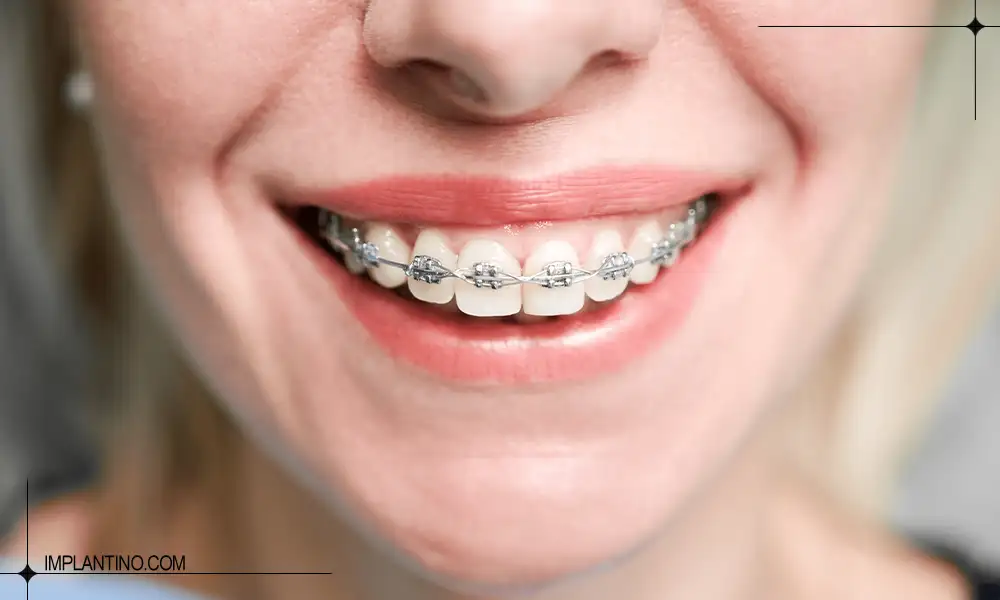 ارتودنسی دندان