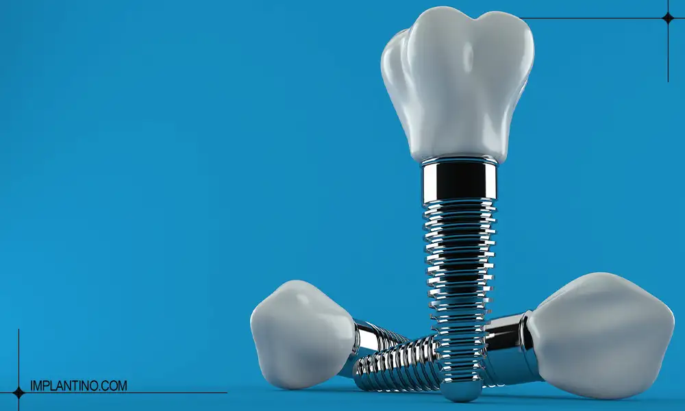 معرفی ایمپلنت cmi کره ای 3 ایمپلنت cmi