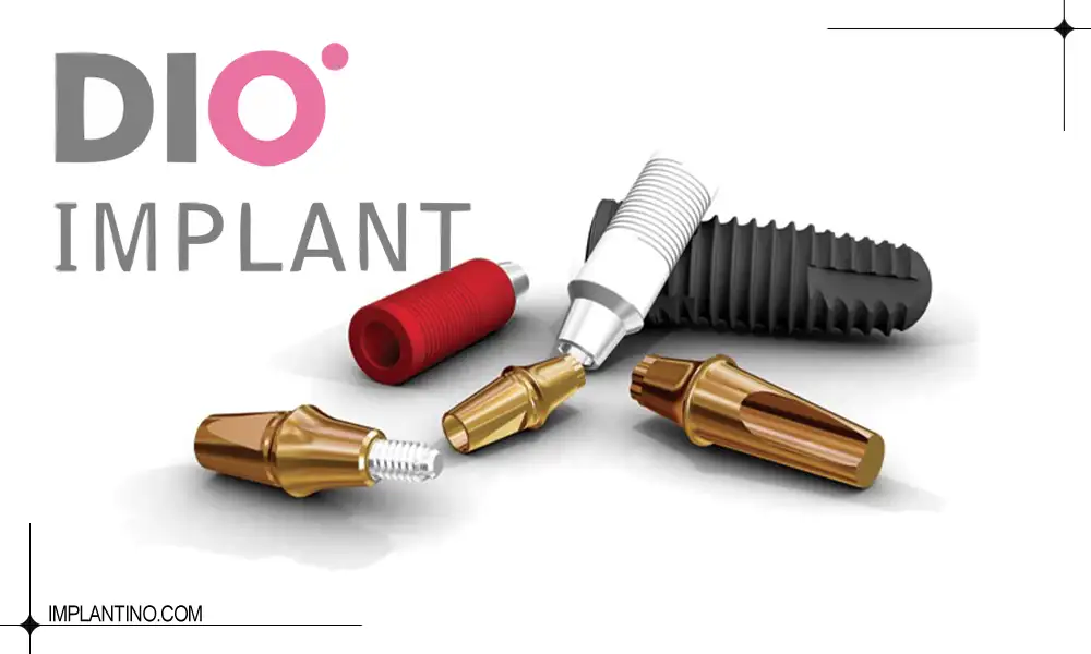 انواع ایمپلنت دیو کره ای