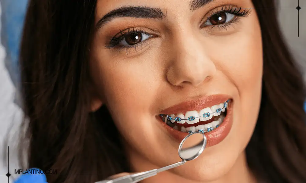 خانمی که لبخند زده و دارای ارتودنسی دندان است.