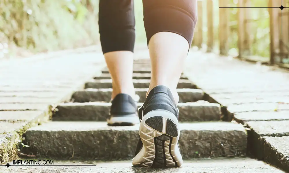 چگونگی پیاده روی بعد از ایمپلنت دندان 3 ورزش و پیاده روی بعد از ایمپلنت