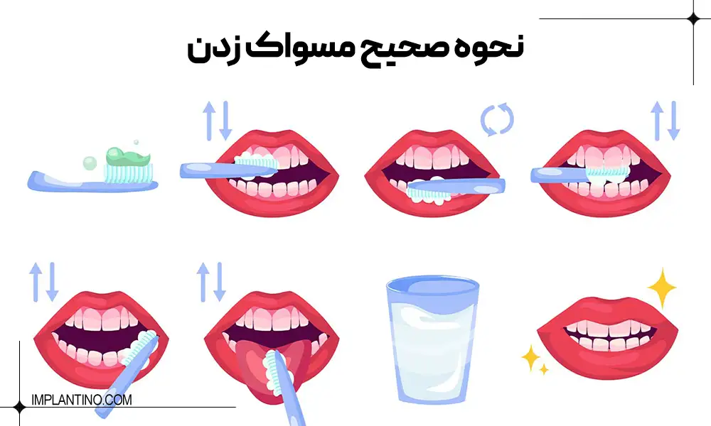 عکس نحوه صحیح مسواک زدن