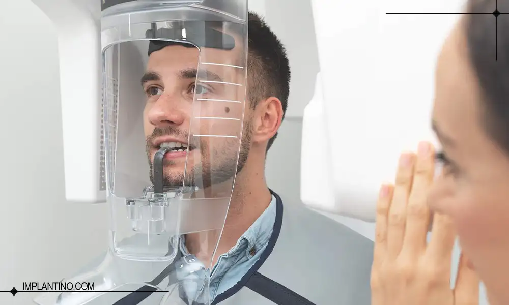 نحوه گرفتن عکس opg