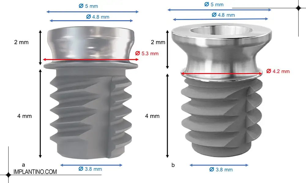 سایز و انداره ایمپلنت پایه کوتاه