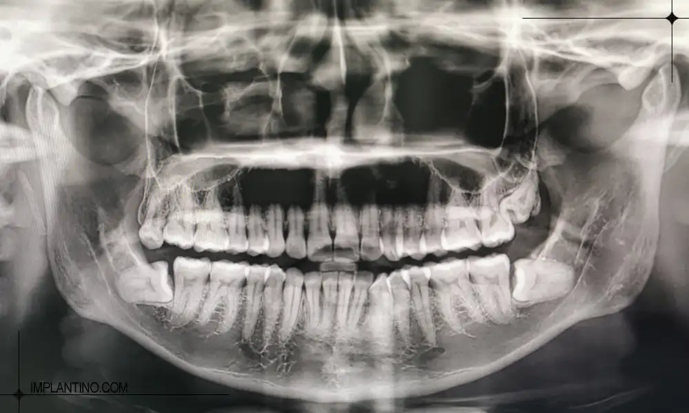 نمونه عکس opg