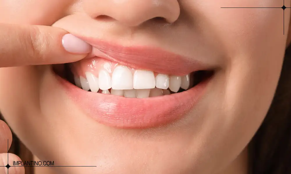 خانم در حال نشان دادن مینای دندان سالم و براق خود