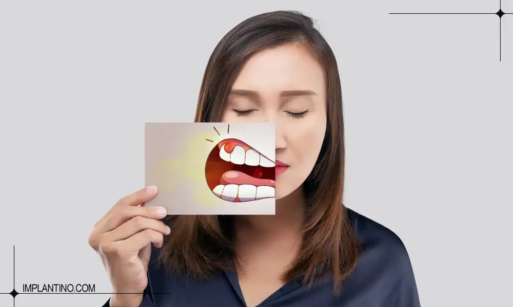 عکس آبسه دندان