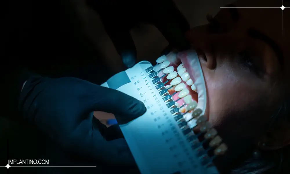 انتخاب بهترین رنگ کامپوزیت دندان در زیر نور روشن