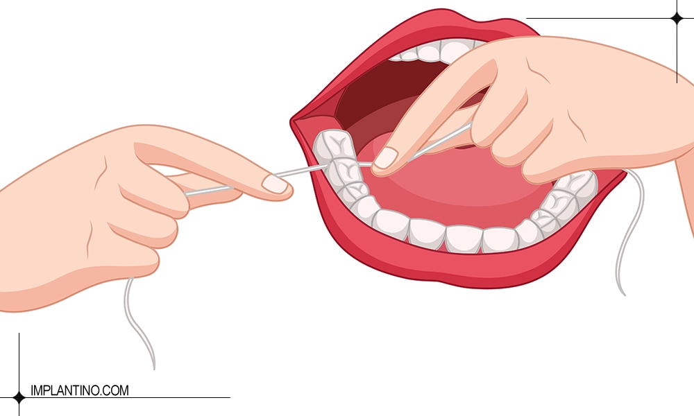 آشنایی با نحوه صحیح نخ دندان کشیدن 3 نخ دندان کشیدن عقب