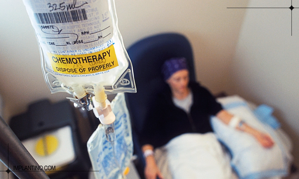 شیمی درمانی در دندان و سرطان