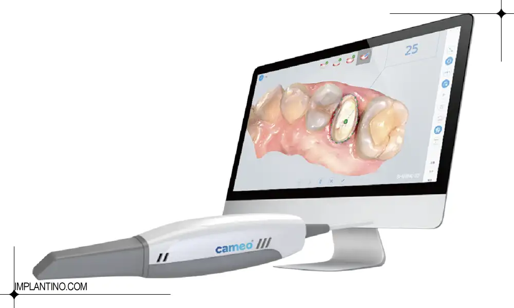 معرفی اسکنر داخل دهانی و کاربردهای آن 2 دستگاه اسکنر داخل دهانی و تصویر گزفته شده از دهان و دندان بیمار