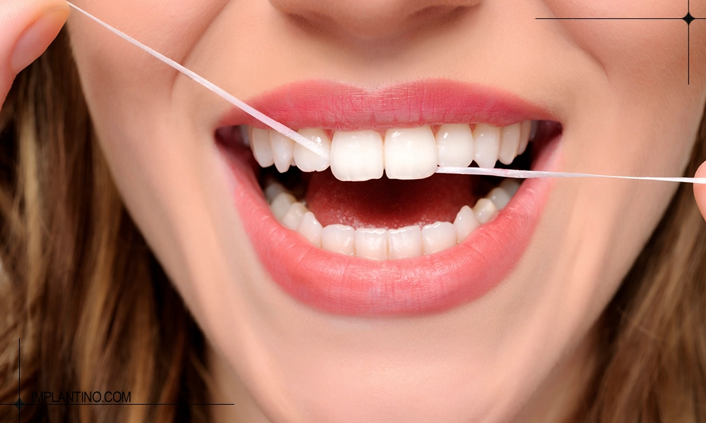آشنایی با نحوه صحیح نخ دندان کشیدن 1 خانم در حال نخ دندان کشیدن دندان های جلویی