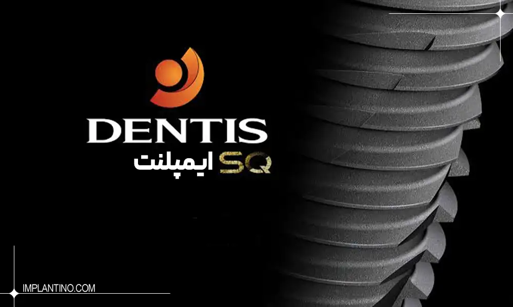 معرفی ایمپلنت دنتیس