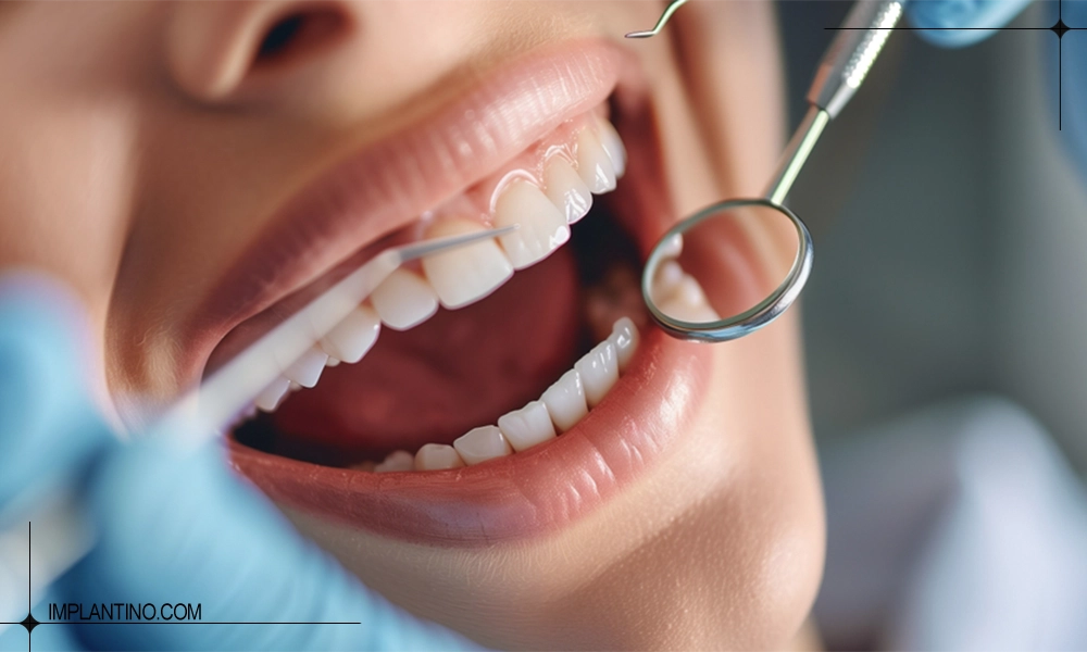 دندان های زیبای یک خانم با بهداشت دهان و دندان در کلینیک