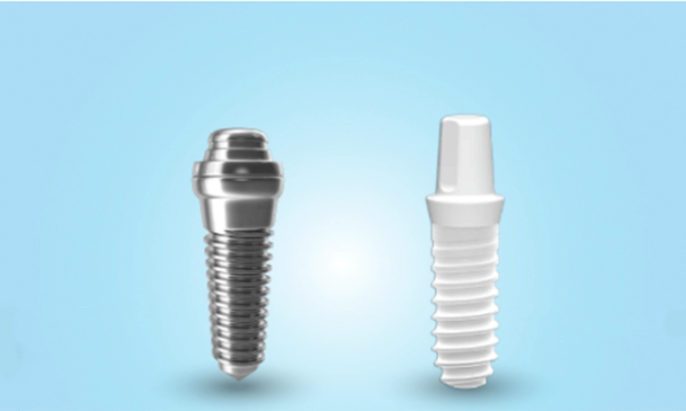 تفاوت اصلی بین ایمپلنت زیرکونیا و تیتانیوم 2 ایمپلنت زیرکونیا و تیتانیوم