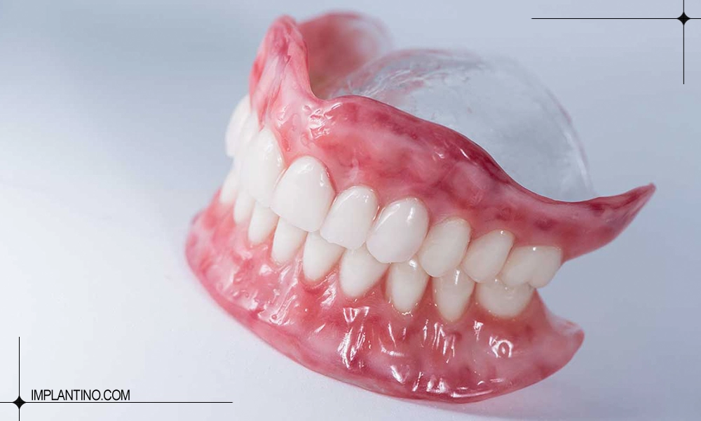 شکل دندان مصنوعی فک بالا و پایین 