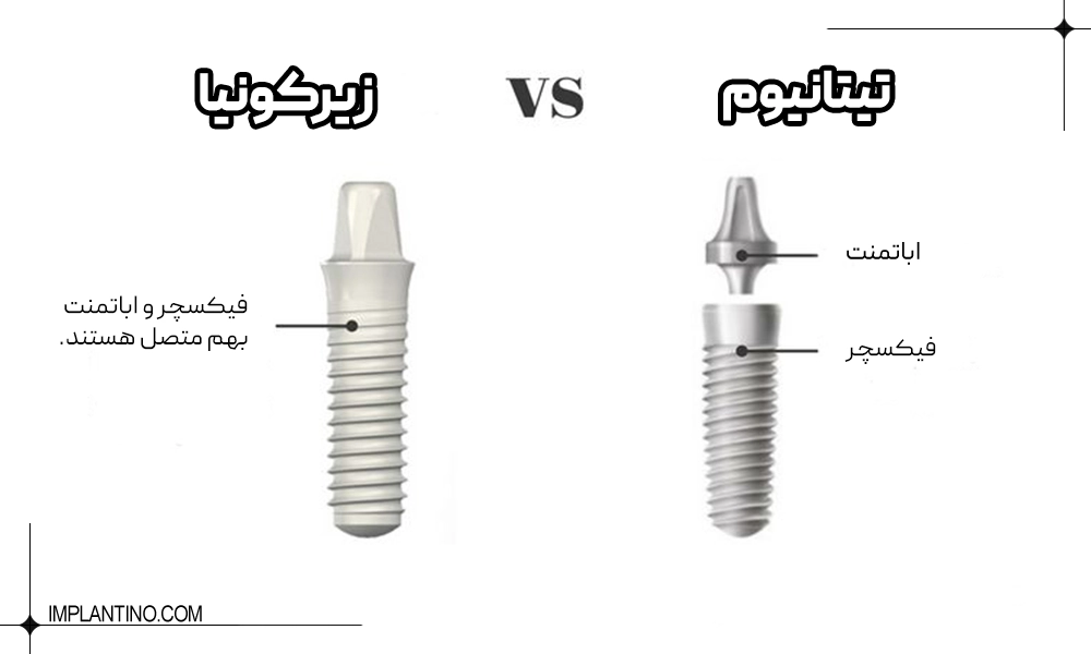 تفاوت اصلی بین ایمپلنت زیرکونیا و تیتانیوم 1 فرق ایمپلنت زیرکونیا و تیتانیوم