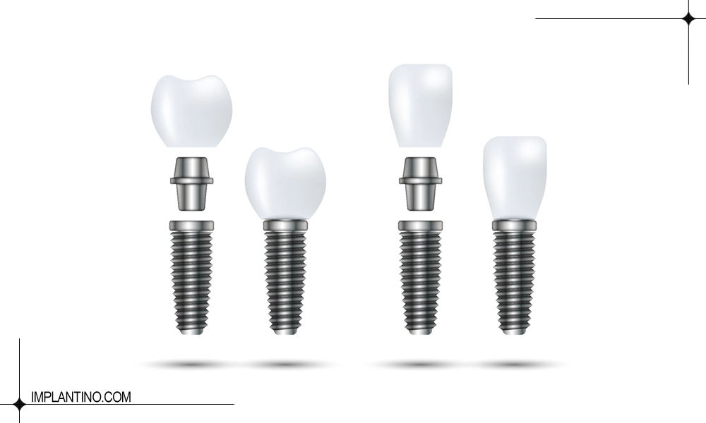 ایمپلنت های مورد استفاده در مرکز ایمپلنت در تهران