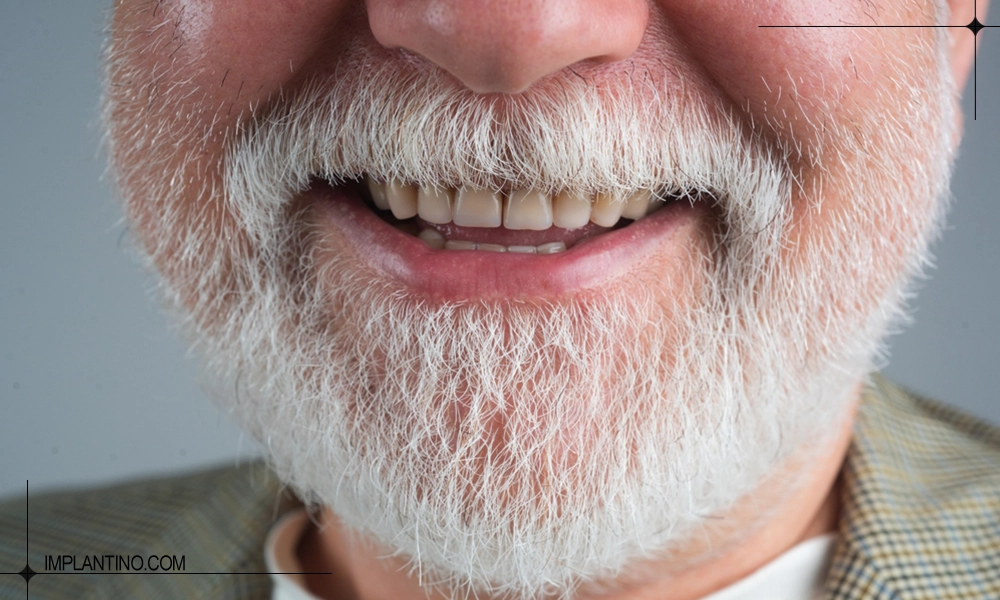 ایمپلنت در سن بالا