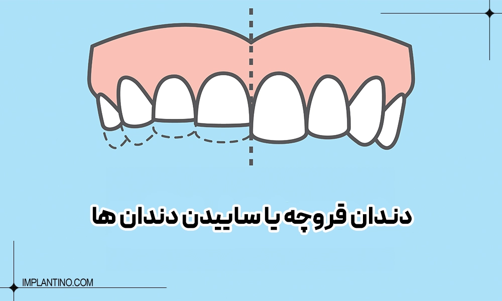 عکس دندان قروچه