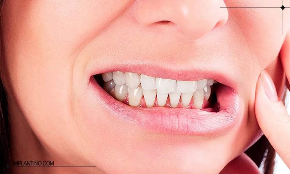 دندان قروچه یا ساییدن دندان چه زمانی اتفاق می افتد؟ 2 دندان قروچه