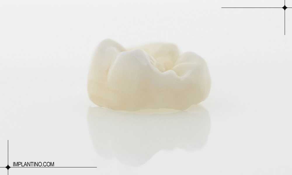 عکس روکش دندان