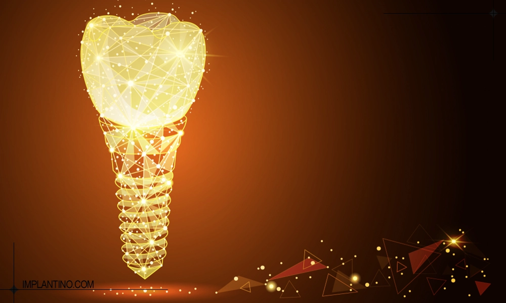 عکس انیمه ایمپلنت طلا