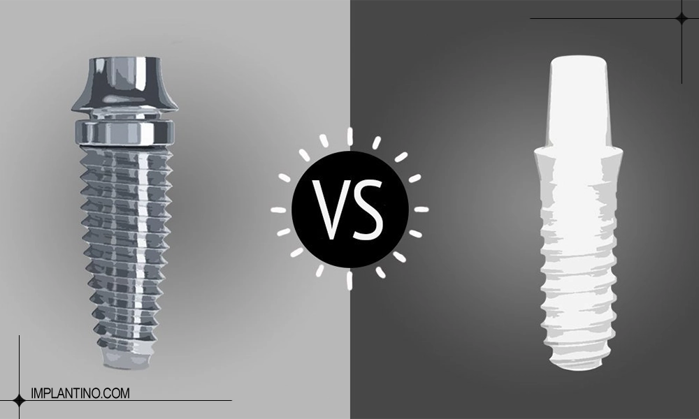 عکس مقایسه ای ایمپلنت زیرکونیا و تیتانیوم