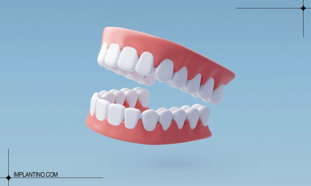 آشنایی با روش های کاشت دندان