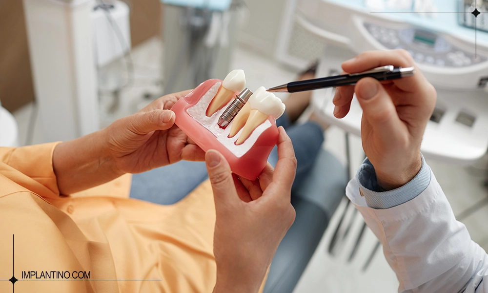 چرا به مشاوره ایمپلنت دندان قبل از کاشت نیاز داریم؟ 2 مشاوره ایمپلنت دندان