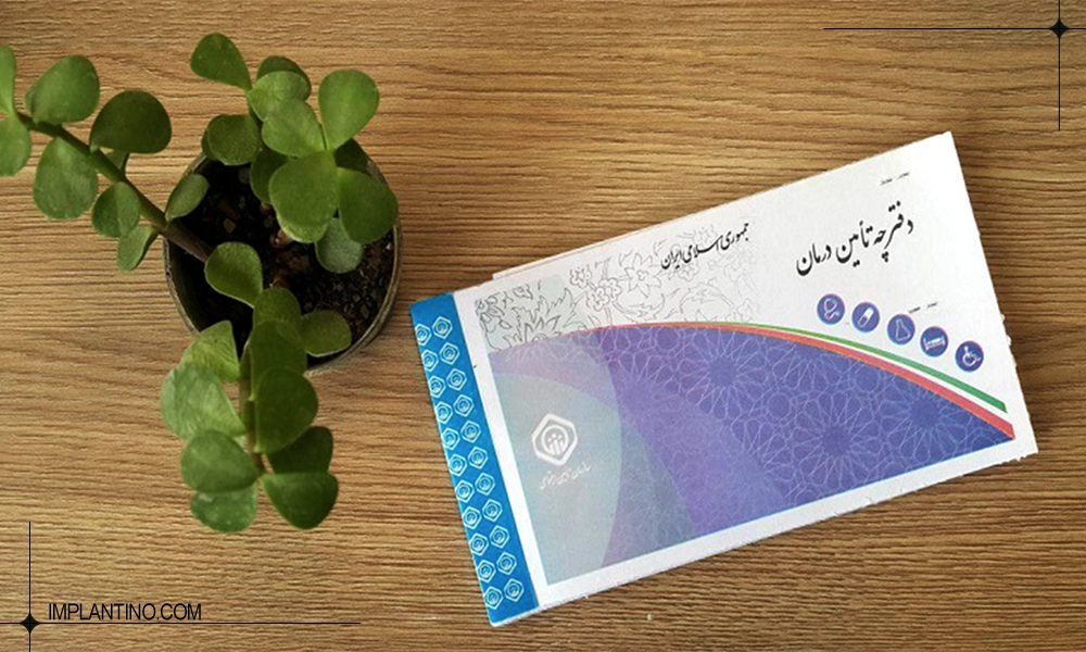 ایمپلنت دندان با بیمه تامین اجتماعی