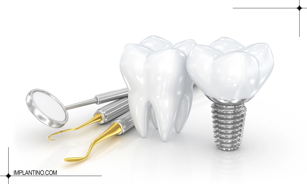 میزان درد ایمپلنت دندان
