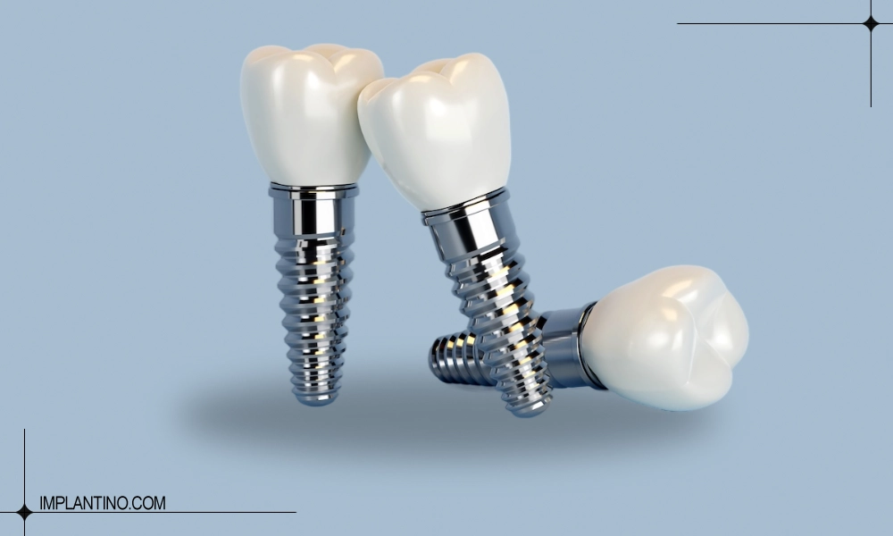 عکس ارزان ترین ایمپلنت