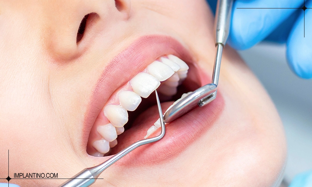 خدمات دندانپزشکی ارزان و با کیفیت برای یک خانم