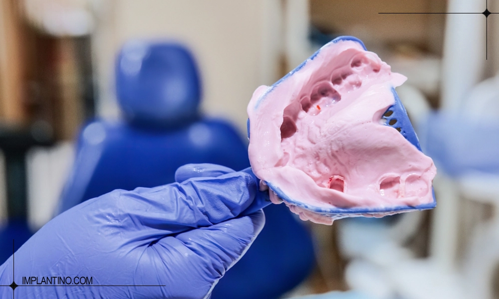 شکل قالب بعد از قالب گیری دندان