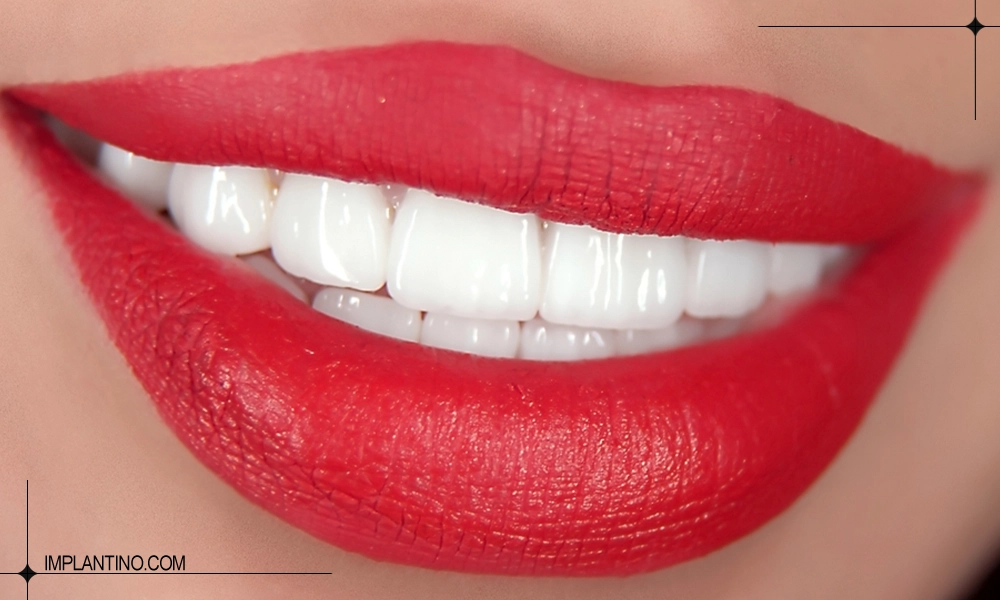 عکس و شکل دندان صدفی