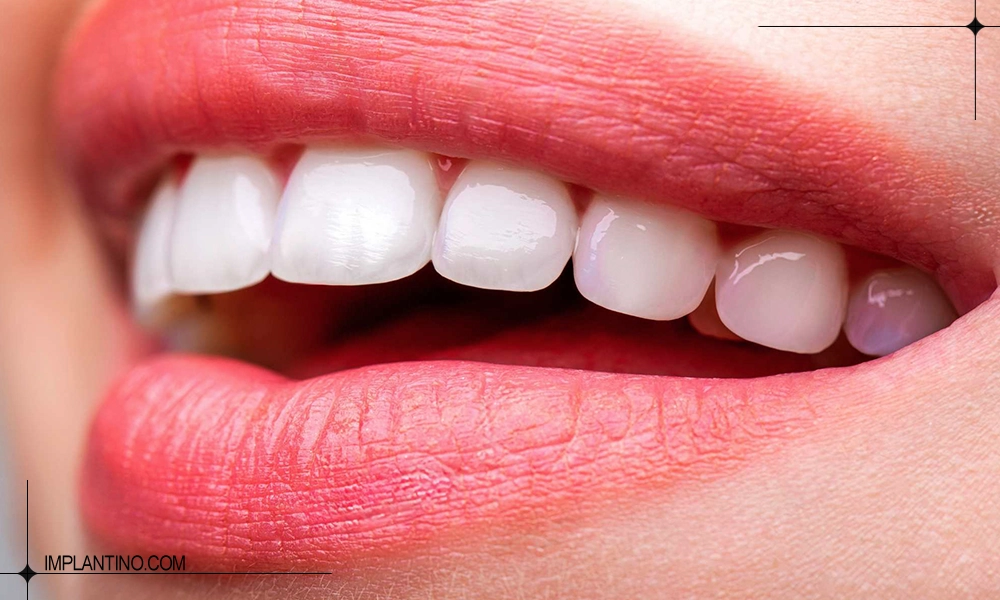 تصویر دندان صدفی