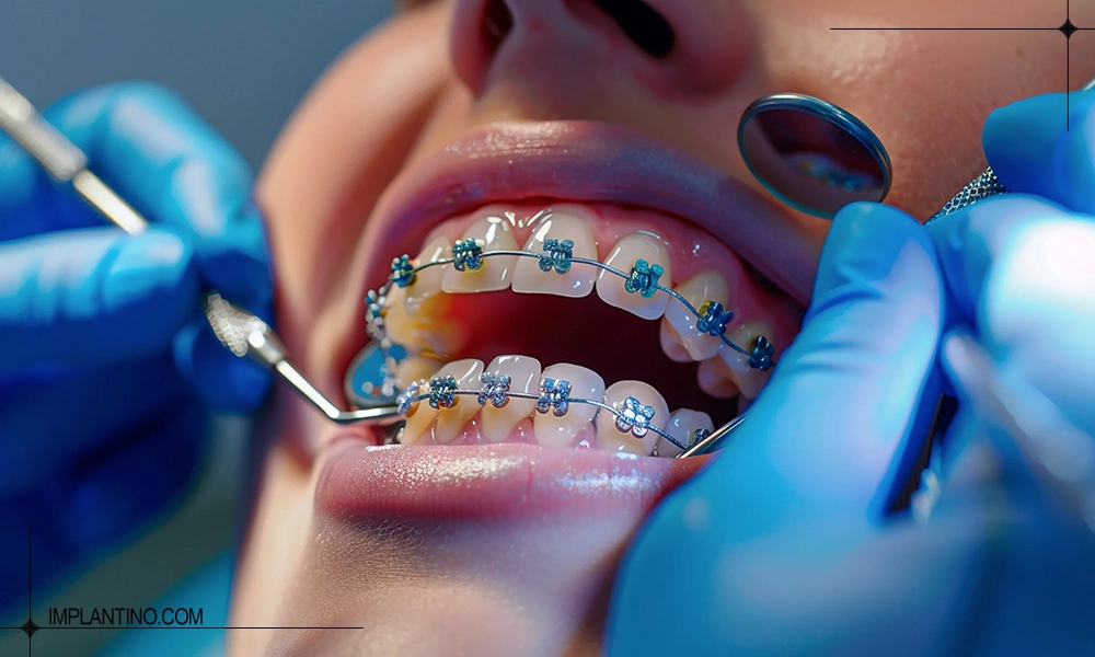 چک کردن دندان ها در مراقبت های بعد از ارتودنسی دندان