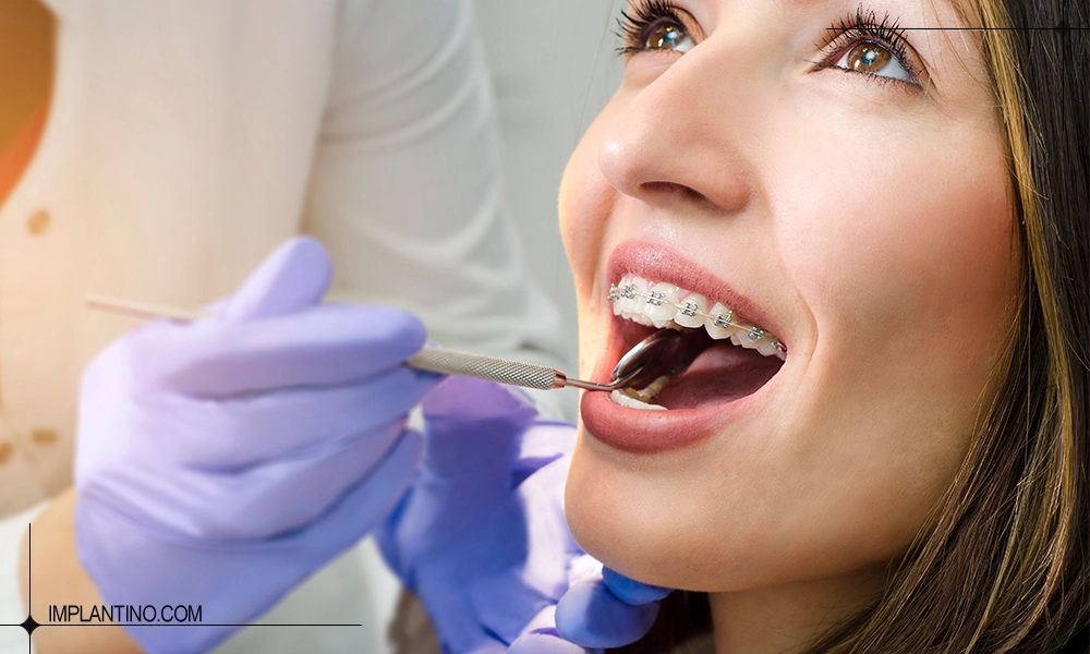 مراقبت های بعد از ارتودنسی دندان