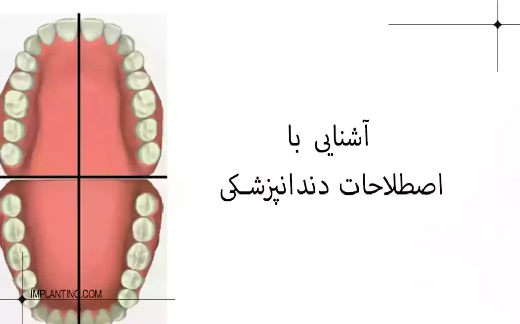 آشنایی با اصطلاحات دندانپزشکی