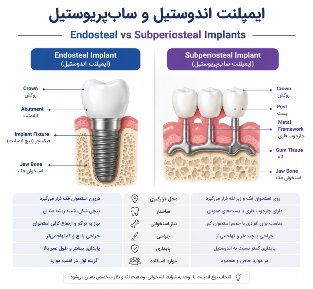 انواع ایمپلنت دندان 1 3177b736 e15c 4168 bbe7 c4067bb68466