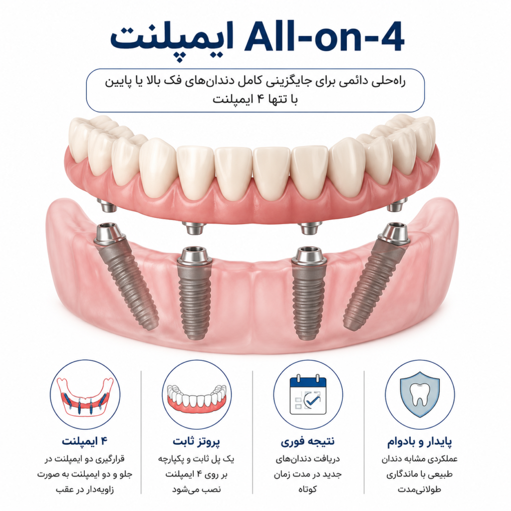 انواع ایمپلنت دندان 2 551b2e8c 98fd 4201 b932 d909fbef2729