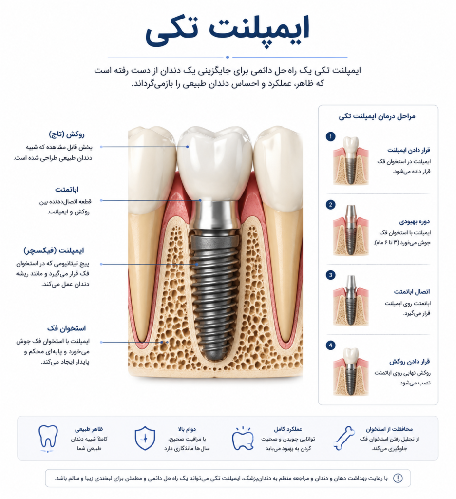 انواع ایمپلنت دندان 3 7914c0f0 96b1 4ced bb53 30832ae70930