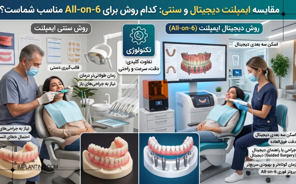 تفاوت ایمپلنت دیجیتال با سنتی: کدام روش (مانند All-on-6) 20 تفاوت ایمپلنت دیجیتال با سنتی 0