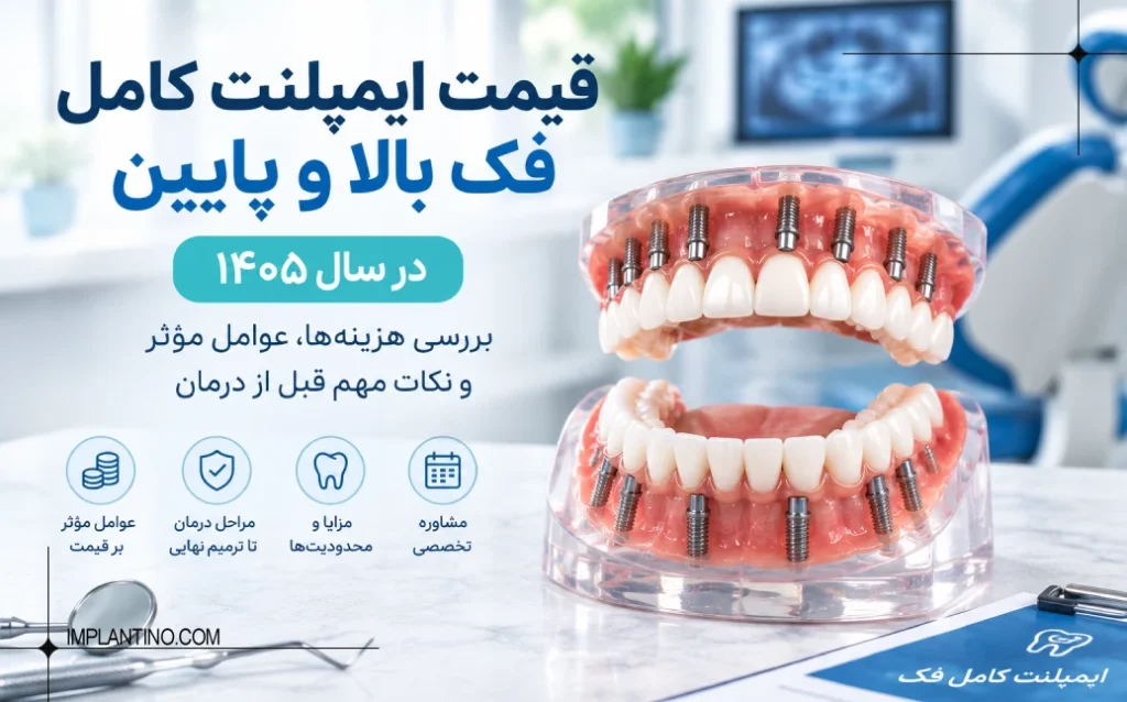 قیمت ایمپلنت کامل 1