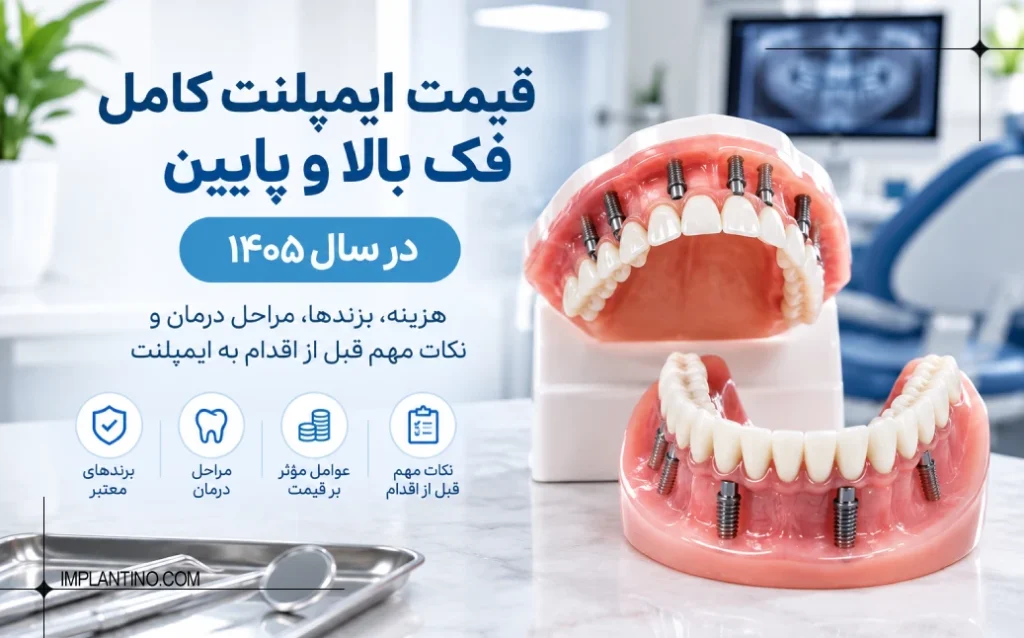 قیمت ایمپلنت کامل 2