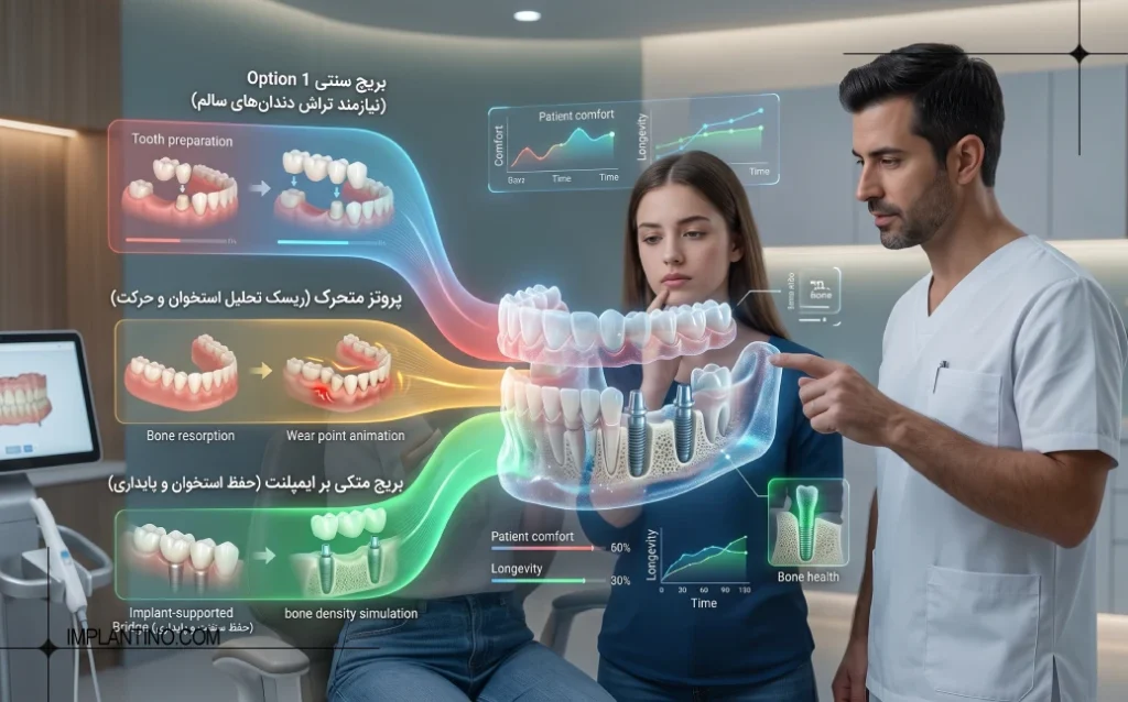 مقایسه ایمپلنت 3
